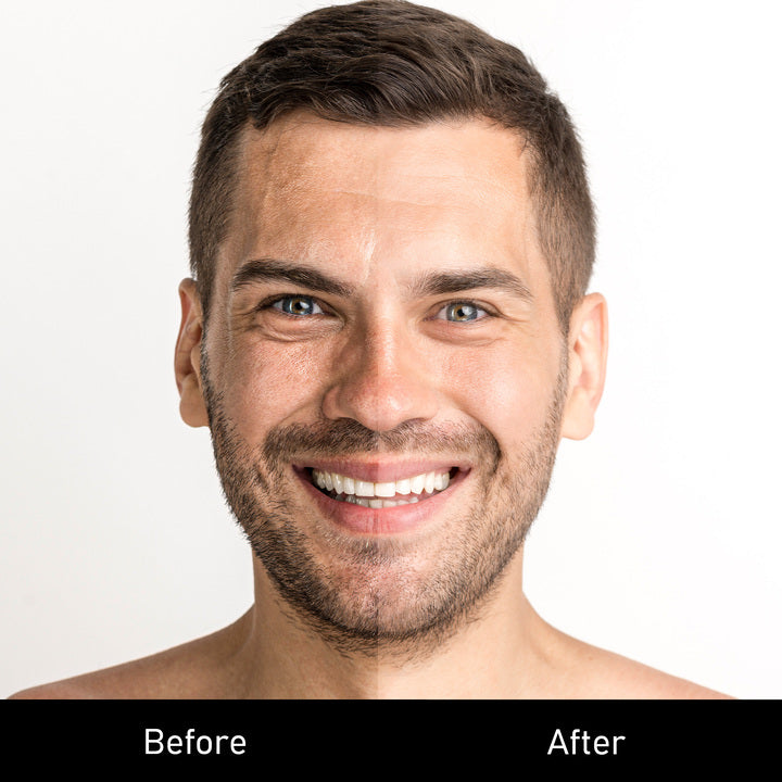 Skin Tint Moisturiser with SPF-15